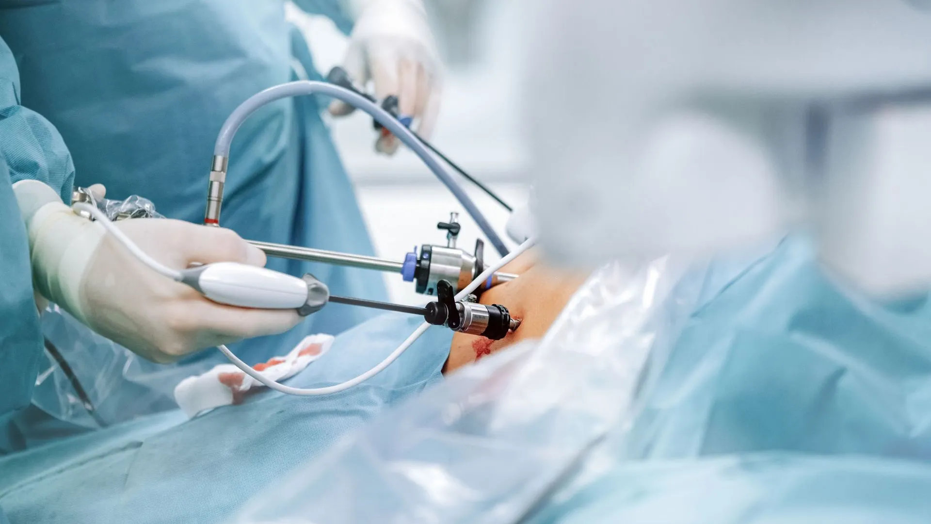 Paciente recibiendo orientación sobre cirugía laparoscópica